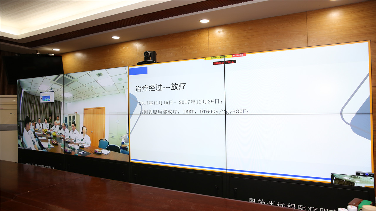 通过远程会诊系统进行探讨交流（二）